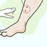 യുവാവിന് പാമ്പുകടിയേറ്റു